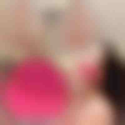 Gesichtsreinigungs-Massagebürste - 12 Geschwindigkeitsstufen | STARGLO